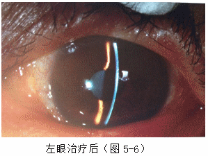 ZY016_21_3.gif